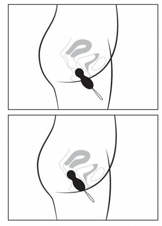 Hula Beads van Lelo instructietekening voor gebruik bekkenbodemballetjes twee posities